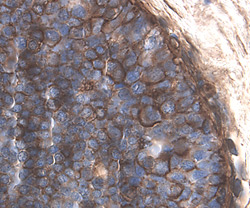 CD59 antibody in Human Breast by Immunohistochemistry (IHC-P).