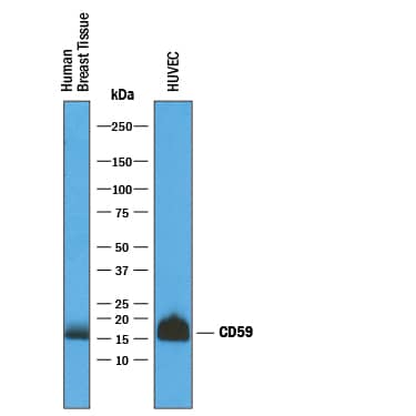 Detection of Human CD59 antibody by Western Blot.