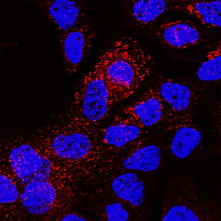 CD63 antibody in A431 Human Cell Line by Immunocytochemistry (ICC).