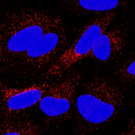 CD63 antibody in A549 Human Cell Line by Immunocytochemistry (ICC).