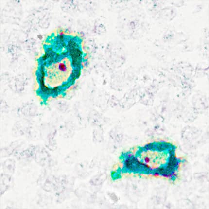 CD68/SR-D1 antibody in Human Tonsil Using Dual RNAscope®ISH and IHC.