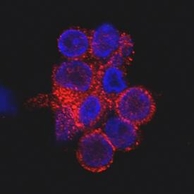 CD69 antibody in Human PBMCs by Immunocytochemistry (ICC).