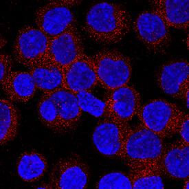 CD72 antibody in Ramos Human Cell Line by Immunocytochemistry (ICC).