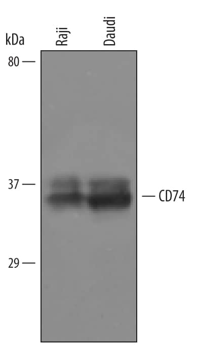 Detection of Human CD74 antibody by Western Blot.