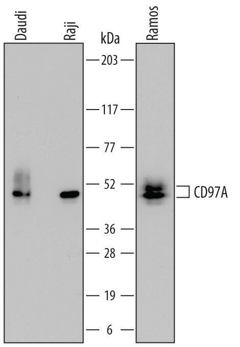 Detection of Human CD79A antibody by Western Blot.