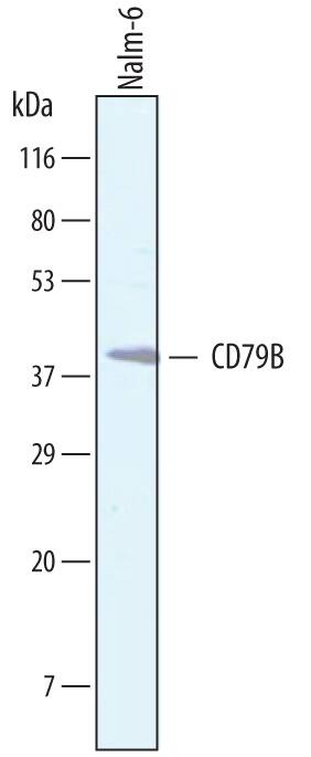 Detection of Human CD79B antibody by Western Blot.