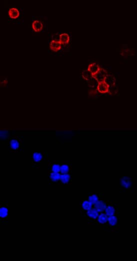 CD79B antibody in Mouse Splenocytes by Immunocytochemistry (ICC).