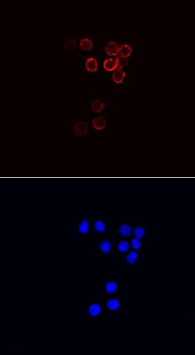 CD79B antibody in Mouse Splenocytes by Immunocytochemistry (ICC).