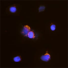 CD7 antibody in Human PBMCs by Immunocytochemistry (ICC).