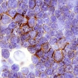 CD7 antibody in Human Thymus by Immunohistochemistry (IHC-P).