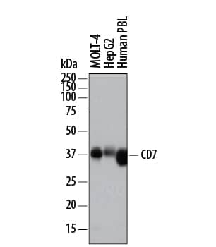 Detection of Human CD7 antibody by Western Blot.