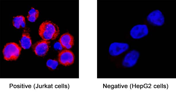 CD81 antibody in Jurkat human acute T cell leukemia cell line by Immunocytochemistry (ICC).