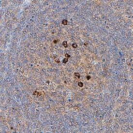 CD81 antibody in Human Tonsil by Immunohistochemistry (IHC-P).