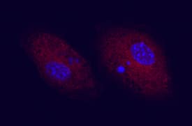 CD83 antibody in Mouse Dendritic Cells by Immunocytochemistry (ICC).