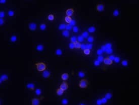 CD8a antibody in Mouse Splenocytes by Immunocytochemistry (ICC).