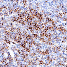 CD8a antibody in Human Tonsil by Immunohistochemistry (IHC-P).