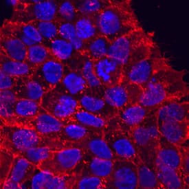 CD90/Thy1 antibody in BG01V Human Embyonic Stem Cells by Immunocytochemistry (ICC).