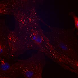 CD90/Thy1 antibody in Porcine Mesenchymal Stem Cells by Immunocytochemistry (ICC).