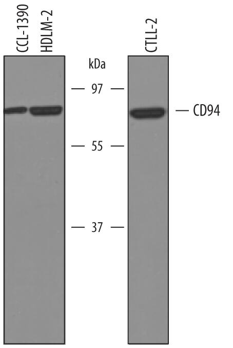 Detection of Human, Mouse, and Canine CD94 antibody by Western Blot.