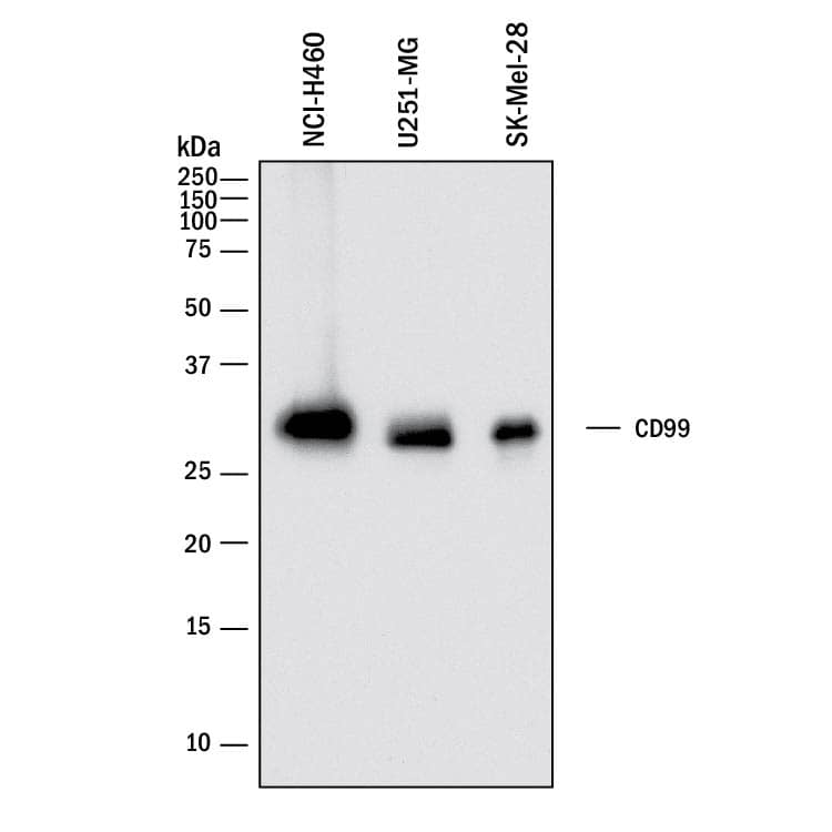 Detection of Human CD99 antibody by Western Blot.