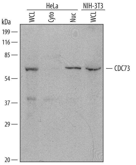 Detection of Human and Mouse CDC73 antibody by Western Blot.