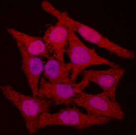 CDK4 antibody in HeLa Human Cell Line by Immunocytochemistry (ICC).