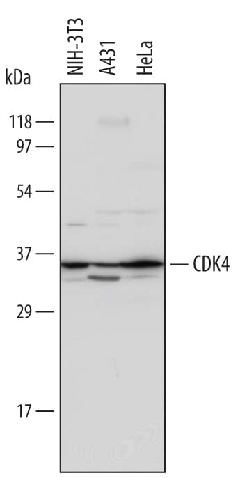 Detection of Human and Mouse CDK4 antibody by Western Blot.