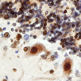 CDK5 Activator 1 antibody in Human Brain by Immunohistochemistry (IHC-P).