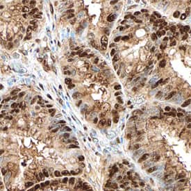 CDK8 antibody in Human Colon by Immunohistochemistry (IHC-P).