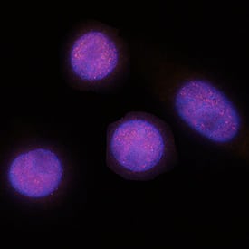 CDX2 antibody in SW480 Human Cell Line by Immunocytochemistry (ICC).