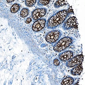 CEACAM-1/CD66a antibody in Human Colon Tissue by Immunohistochemistry (IHC-P).