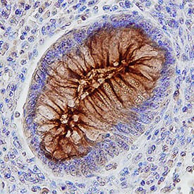 CEACAM-5/CD66e antibody in Human Colon by Immunohistochemistry (IHC-P).