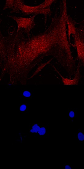 CEBP a antibody in Human Mesenchymal Stem Cells by Immunocytochemistry (ICC).
