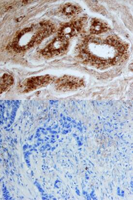 CELSR2 antibody in Human Breast by Immunohistochemistry (IHC-P).