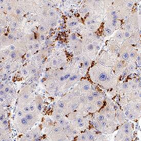 CETP antibody in Human Liver by Immunohistochemistry (IHC-P).