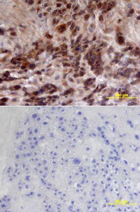 CFTR antibody in Human Placenta by Immunohistochemistry (IHC-P).