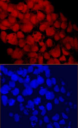 CHD1 antibody in BG01V Human Stem Cells by Immunocytochemistry (ICC).