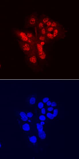 CHD7 antibody in HepG2 Human Cell Line by Immunocytochemistry (ICC).