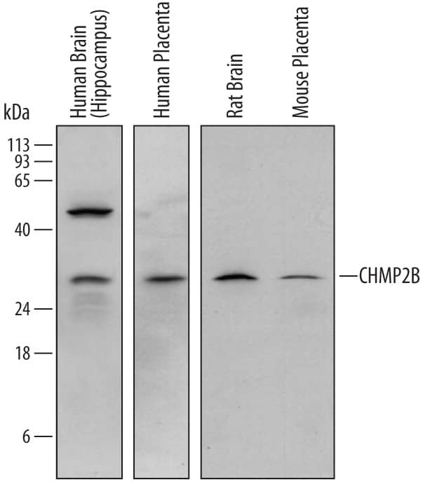 Detection of Human, Mouse, and Rat CHMP2B antibody by Western Blot.