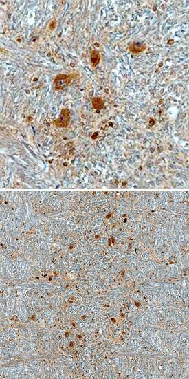 CHMP2B antibody in Human Brain by Immunohistochemistry (IHC-P).