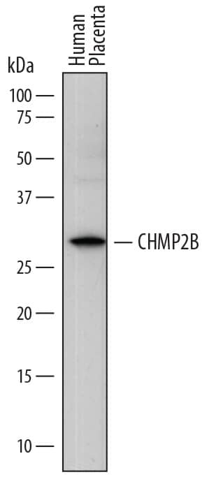 Detection of Human CHMP2B antibody by Western Blot.