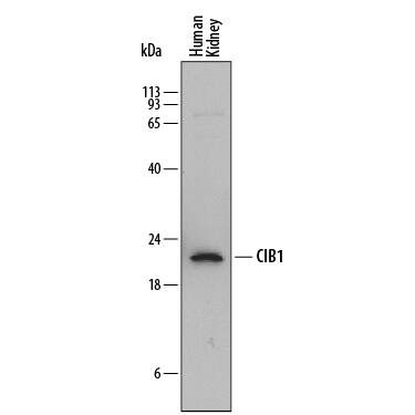 Detection of Human CIB1 antibody by Western Blot.