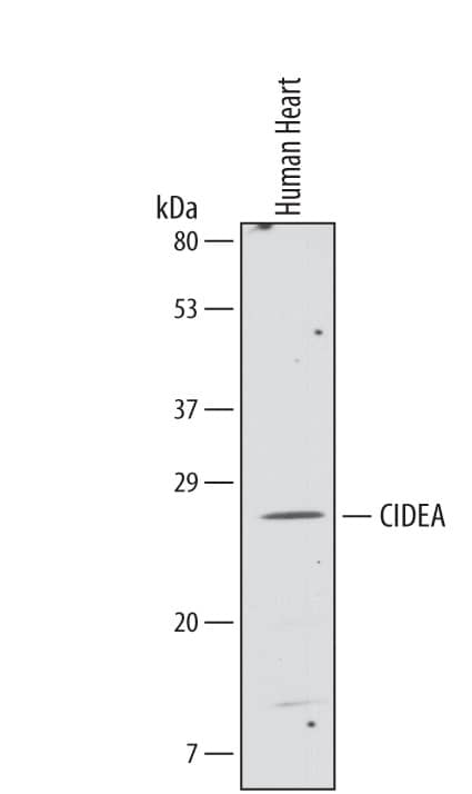 Detection of Human CIDEA antibody by Western Blot.