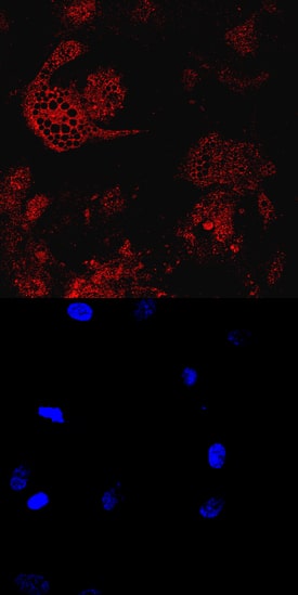 CIDEC antibody in Human Mesenchymal Stem Cells by Immunocytochemistry (ICC).