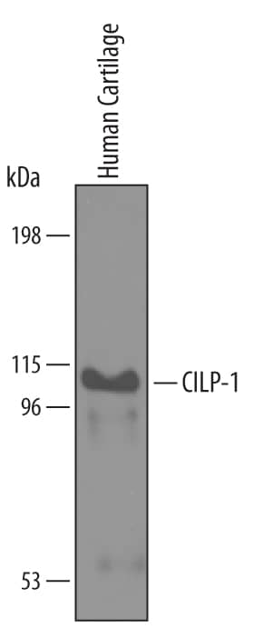 Detection of Human CILP-1 N-Terminal Fragment antibody by Western Blot.