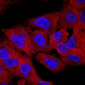 CIN85/SH3KBP1 antibody in A549 Human Cell Line by Immunocytochemistry (ICC).