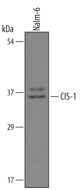 Detection of Human CIS-1 antibody by Western Blot.