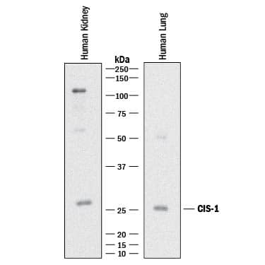 Detection of Human CIS-1 antibody by Western Blot.