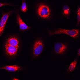 CKAP4/p63 antibody in HeLa Human Cell Line by Immunocytochemistry (ICC).