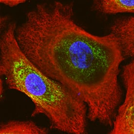 CKAP4/p63 antibody in NHEK Human Normal Epidermal Keratinocytes by Immunocytochemistry (ICC).
